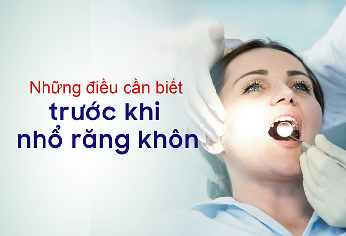 lưu ý trước khi nhổ răng khôn